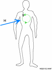 Electric current induced in the body by a magnetic field Source : BBEMG