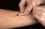 Traditional skin tests do not detect drug resistance.