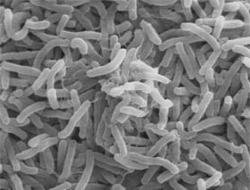 Exemple: Bacilles du choléra 