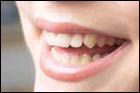 Blanchiment des dents