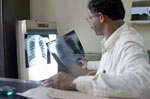 Er wordt een groot aantal nieuwe gevallen van TB vastgesteld in
                    India.