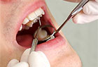 Mercure dans les amalgames dentaires