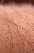 body hair movement induced by static electic fields